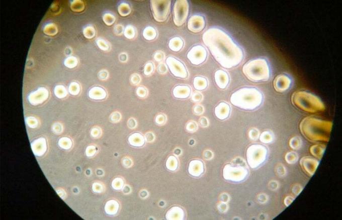 βακτήρια που φαίνονται στο μικροσκόπιο