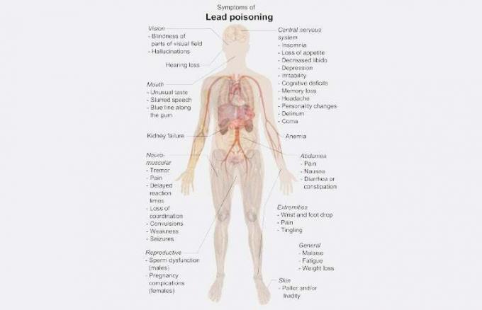 Symptome einer Bleivergiftung