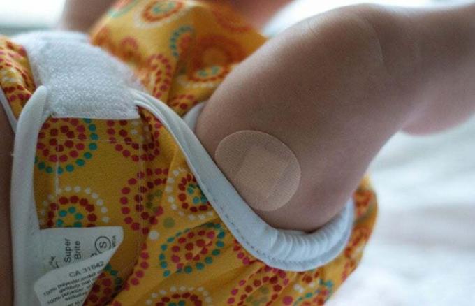 μωρό που φοράει μπάντα μετά τον εμβολιασμό