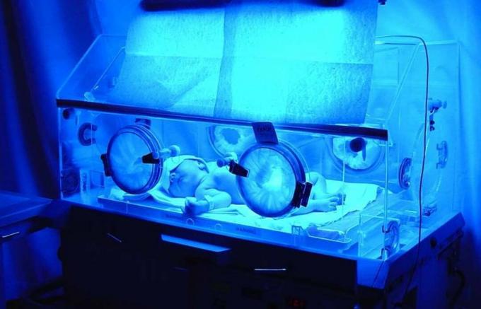 kūdikis inkubatoriuje