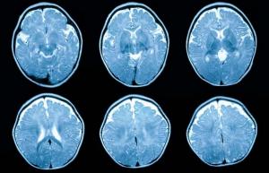 Neurovědci mohou nyní sledovat bolest dítěte pomocí skenování mozku